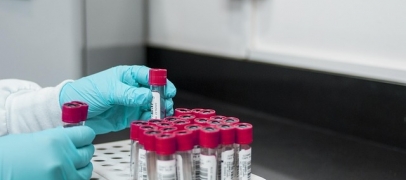 Septembre Rouge : 3 rendez-vous contre les cancers du sang dans la m&eacute;tropole st&eacute;phanoise